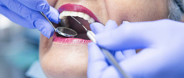 Best Urgent Dental Care  in Wellsville, MO